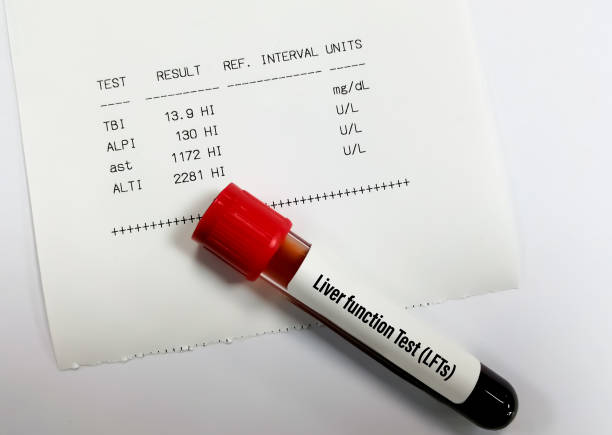 10 Secrets of Liver Function Tests: A Helpful Health Guide